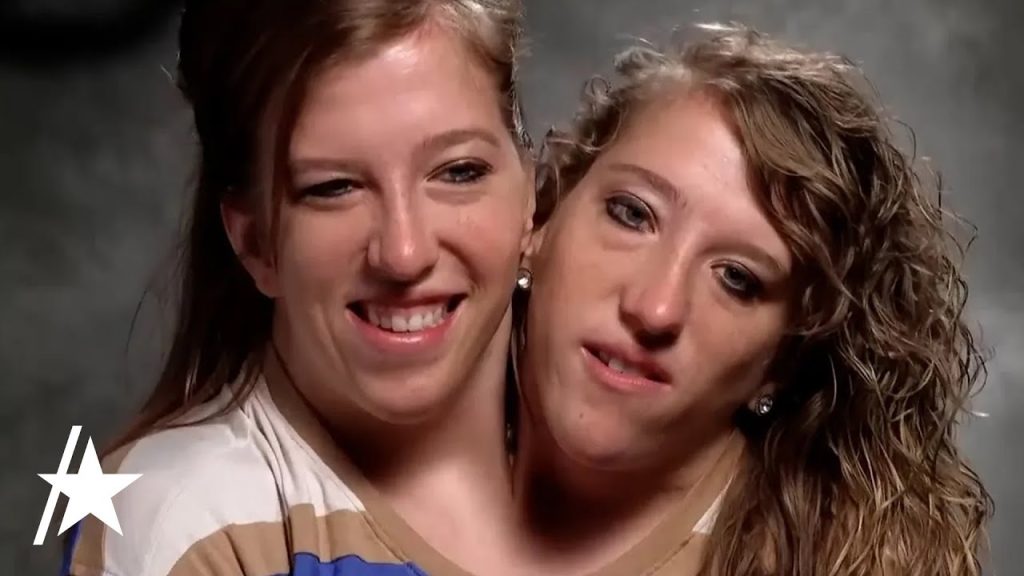 Living a conjoined life