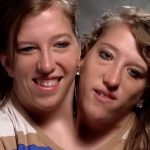 Living a conjoined life