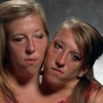 Living a conjoined life…!!