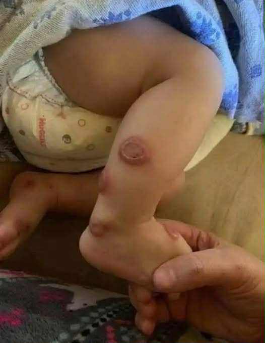 ALERT: These are the signs that it’s cre…